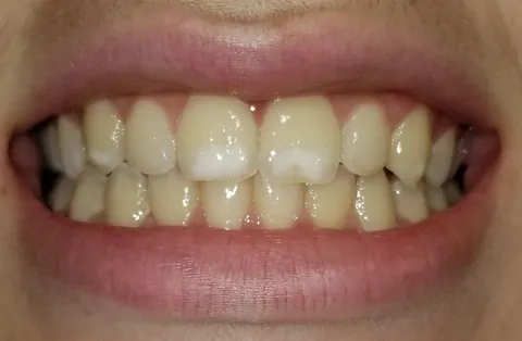 Smile gallery image 5